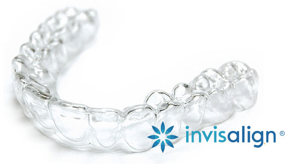 johnson-invisalign-visual