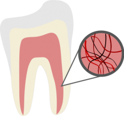 root canal